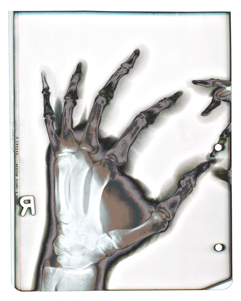 x-rays