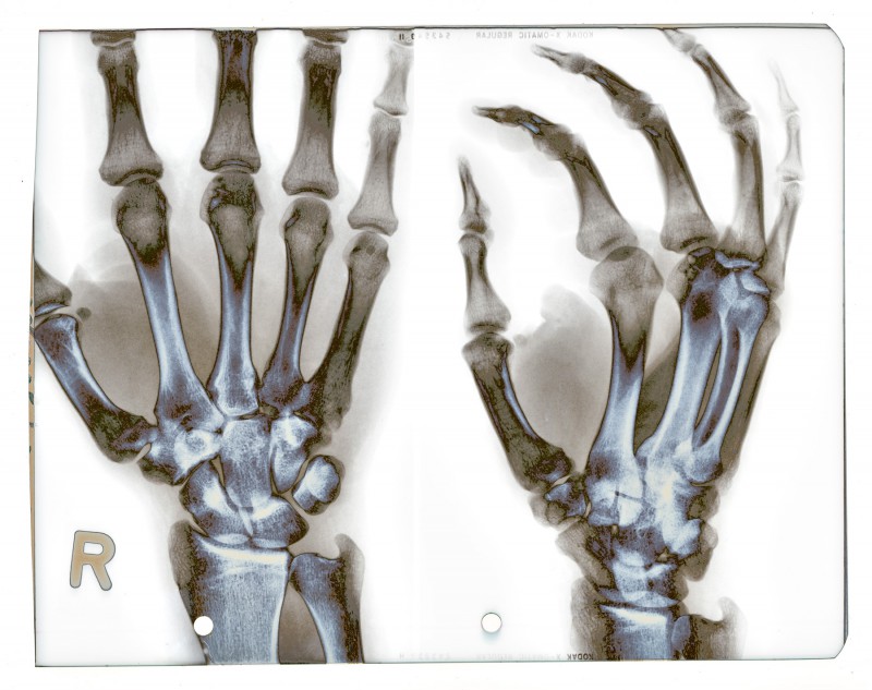 x-rays 
